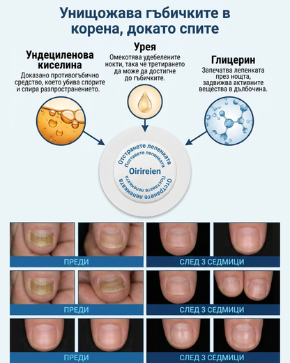 Лепенки за гъбички по ноктите BRUBO