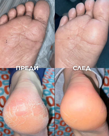 Крем за Сухи и Напукани Пети BRUBO