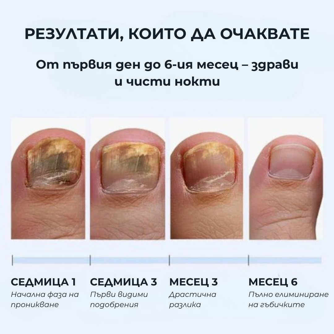 Антигъбична Писалка BRUBO